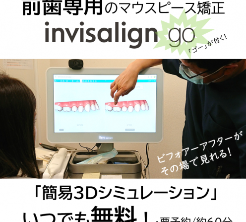 おうちで歯科医院クオリティのホワイトニン