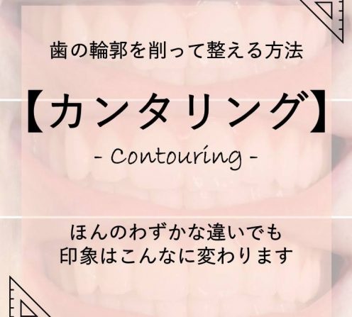 ミスユニバース2022プレリミナリ北海道