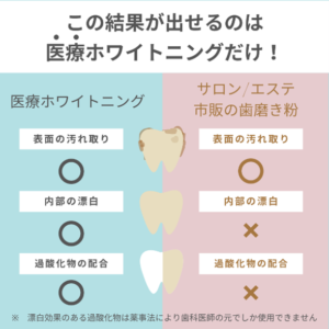 歯科医療ホワイトニングとセルフホワイトニングサロンの違い