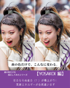 よさこい踊り子のイメージ画像　札幌デンタルケア