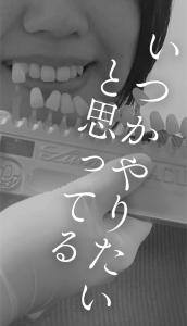 札幌デンタルケア ホワイトニングいつやるの?1/3